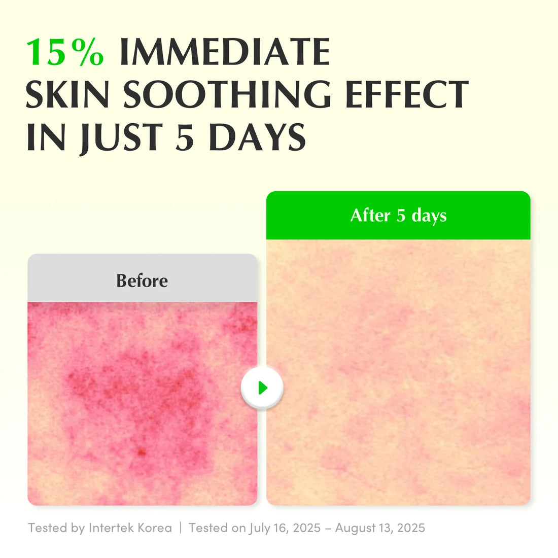 before and after EQQUAL BERRY Green Aid Aloe PDRN Calming Serum 30 ml soothing Korean serum