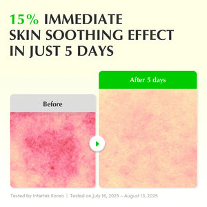 before and after EQQUAL BERRY Green Aid Aloe PDRN Calming Serum 30 ml soothing Korean serum