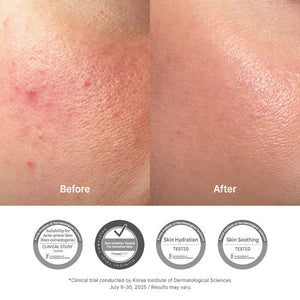before and after poster of Dr.Althea 345 Relief Cream 50 ml soothing barrier repair moisturizer